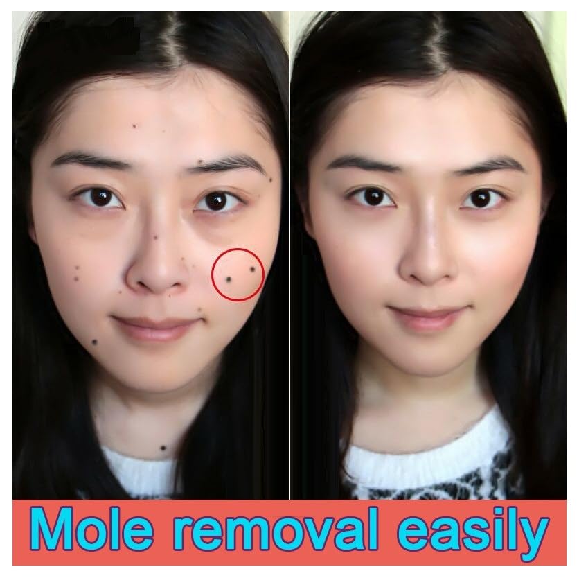 100% Painless Massa Remover Gel for all skin type (pack of 1 )