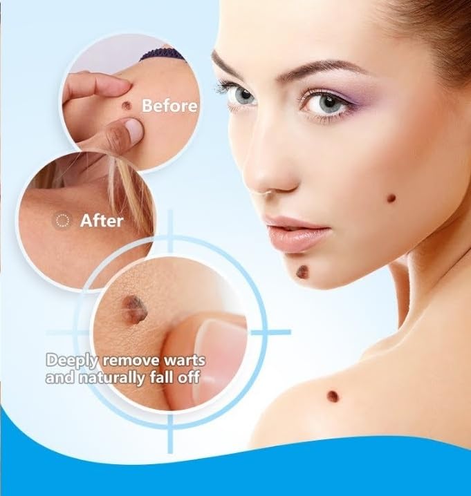 100% Painless Massa Remover Gel for all skin type (pack of 1 )