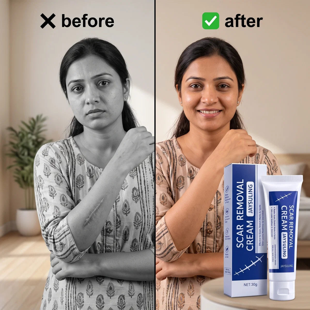 DermaCream™ —Advanced Scar Removal Gel