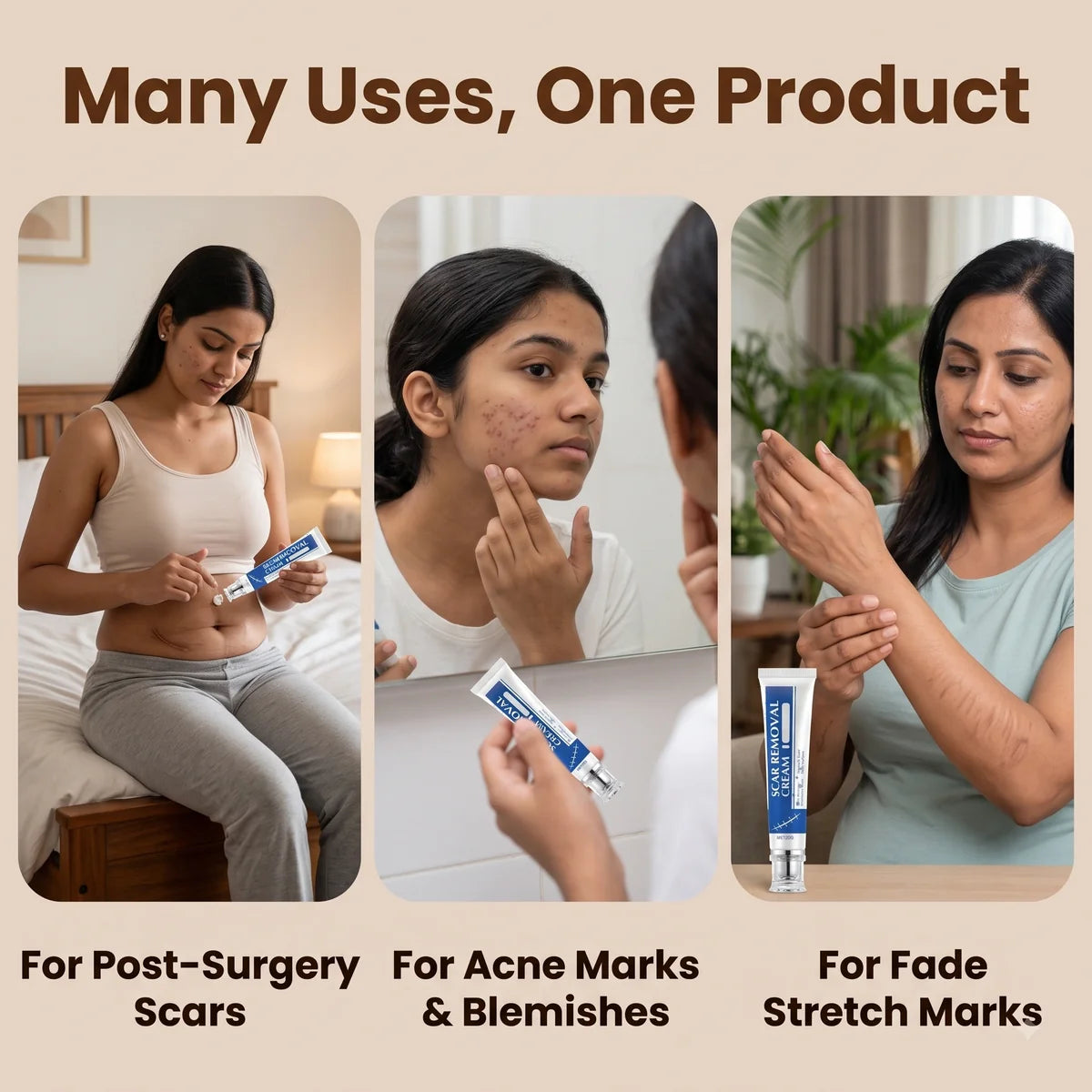 DermaCream™ —Advanced Scar Removal Gel